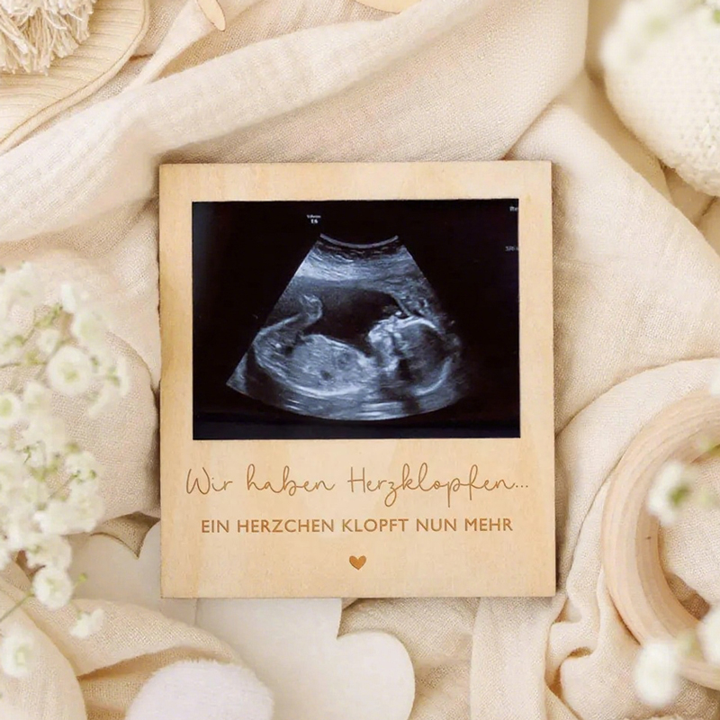 Ultrasound Pregnancy Announcem - Photo Booth Frame บทวิจารณ์และราคา