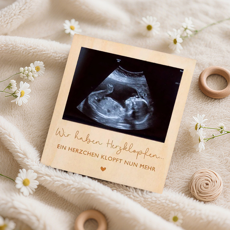 Ultrasound Pregnancy Announcem - Photo Booth Frame บทวิจารณ์และราคา