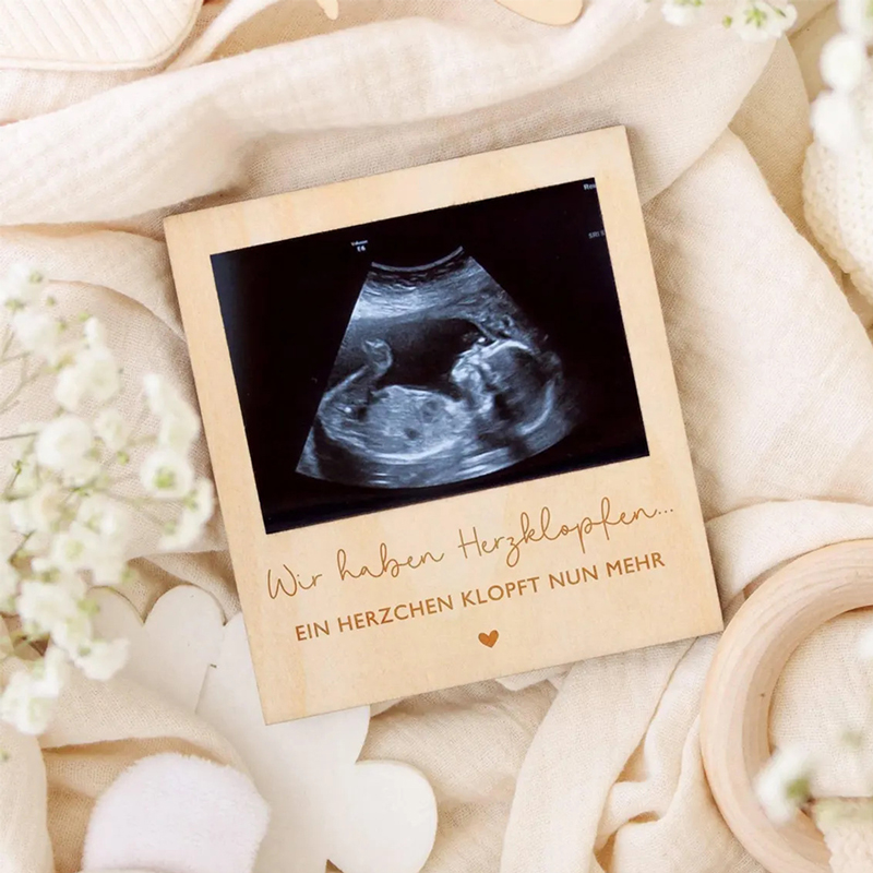 Ultrasound Pregnancy Announcem - Photo Booth Frame บทวิจารณ์และราคา